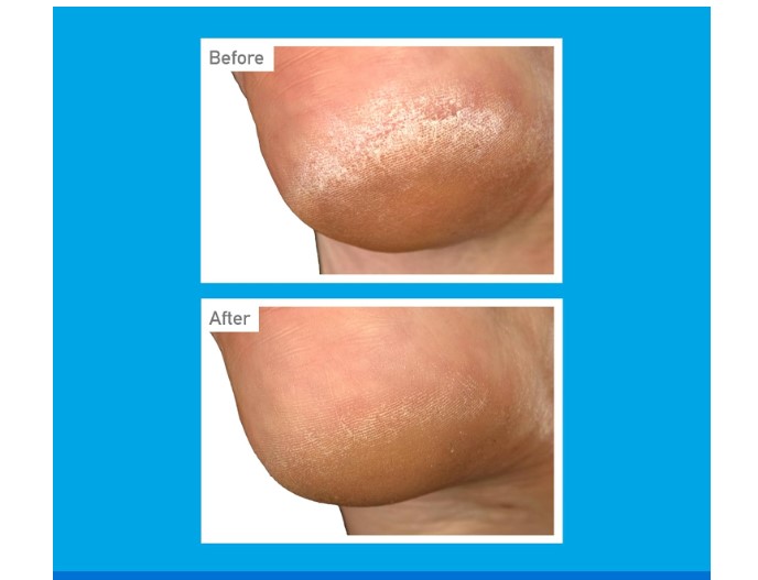 OKK O'Keeffe's for Healthy Feet Overnight Intensive Foot Cream | hydrate | repair | softness | long lasting